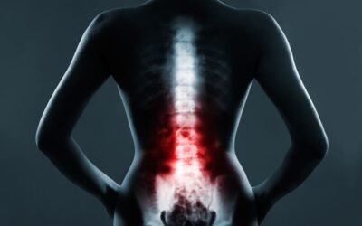 Reasons Witness Evidence Gets Lost in Back Injury Cases and What to Do About It