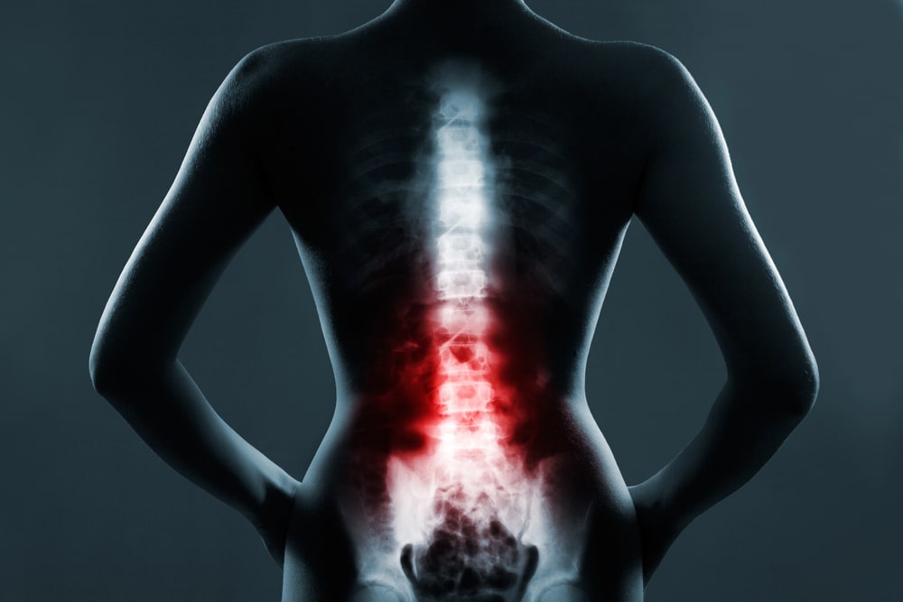 back injury lawyer